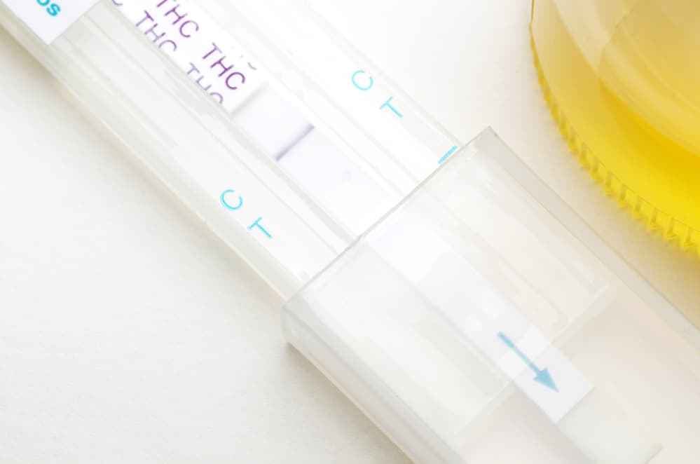 Urine Drug Tests